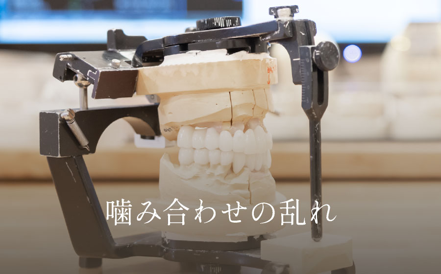 噛み合わせの乱れ