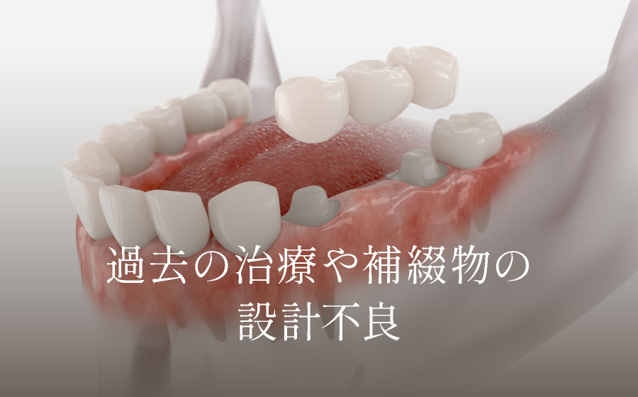 過去の治療や補綴物の設計不良